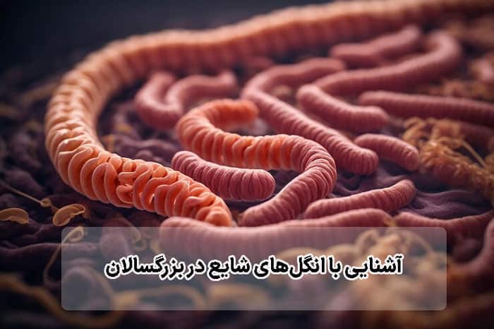 درمان خانگی انگلها در بزرگسالان-آشنایی با انگلهای شایع در بزرگسالان