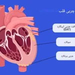 چربی دور قلب چیست و چه عواملی باعث ایجاد آن می شود؟